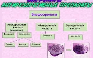 Бисфосфонаты при остеопорозе