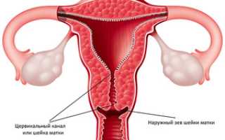 Причины и диагностика заболеваний шейки матки