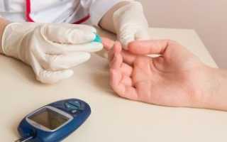 Диабет: симптомы и признаки