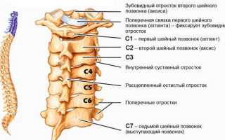 Что такое дорсопатия шейного отдела позвоночника и чем она опасна