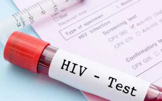 Может ли показать общий анализ крови ВИЧ: какие показатели указывают на вирус