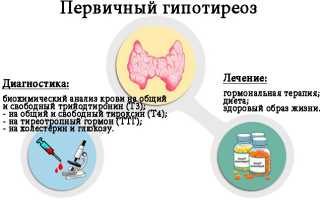 Причины и лечение первичного гипотиреоза щитовидки