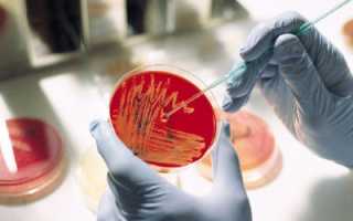 Бак посев мочи на чувствительность к антибиотикам: расшифровка, микрофлора
