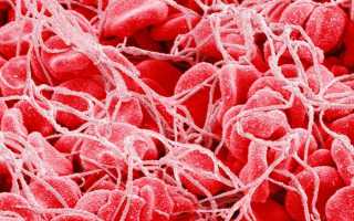 Тромбоцитоз в общем анализе крови: лечение и причины появления