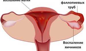 Признаки и способы лечения эрозии шейки матки после родов