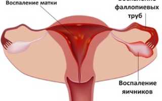 Признаки и способы лечения эрозии шейки матки после родов